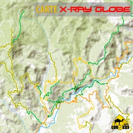Albanien - X-Ray Globe - 1 : 30 000 TOPO